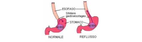 Reflusso esofageo